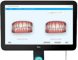 マウスピース矯正（インビザライン）