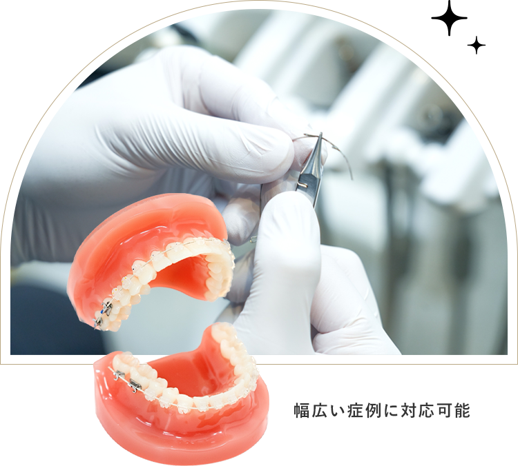 幅広い症例に対応可能