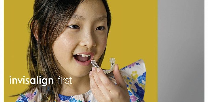 インビザライン・ファーストの特徴