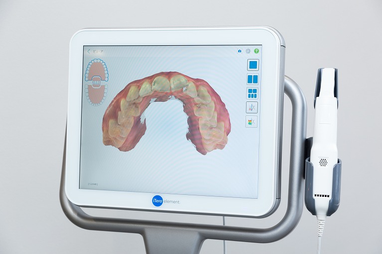 3D口腔内スキャナーiTero（アイテロ）